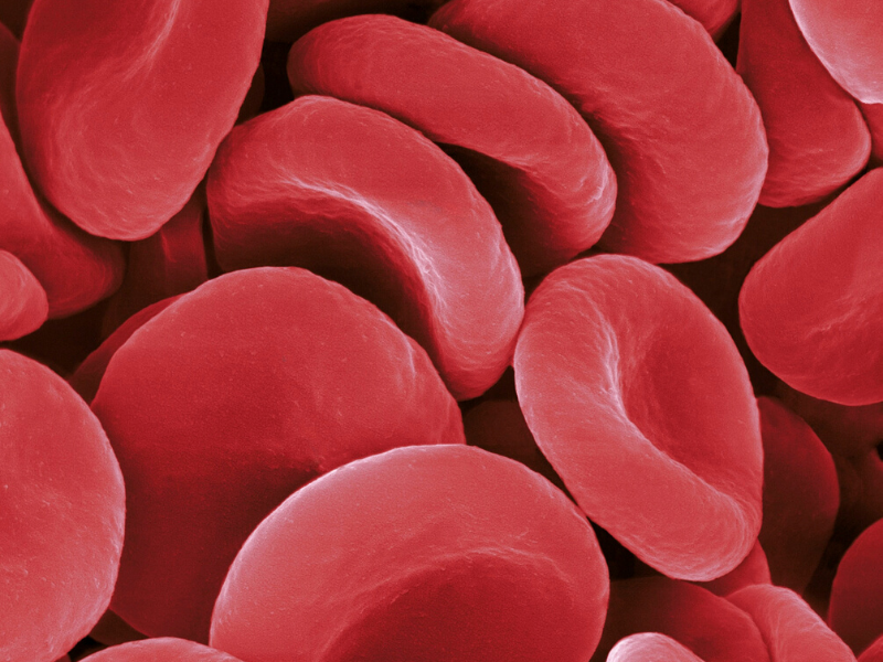 blood-cancer-what-kind-of-types-are-there-chooselifeworld